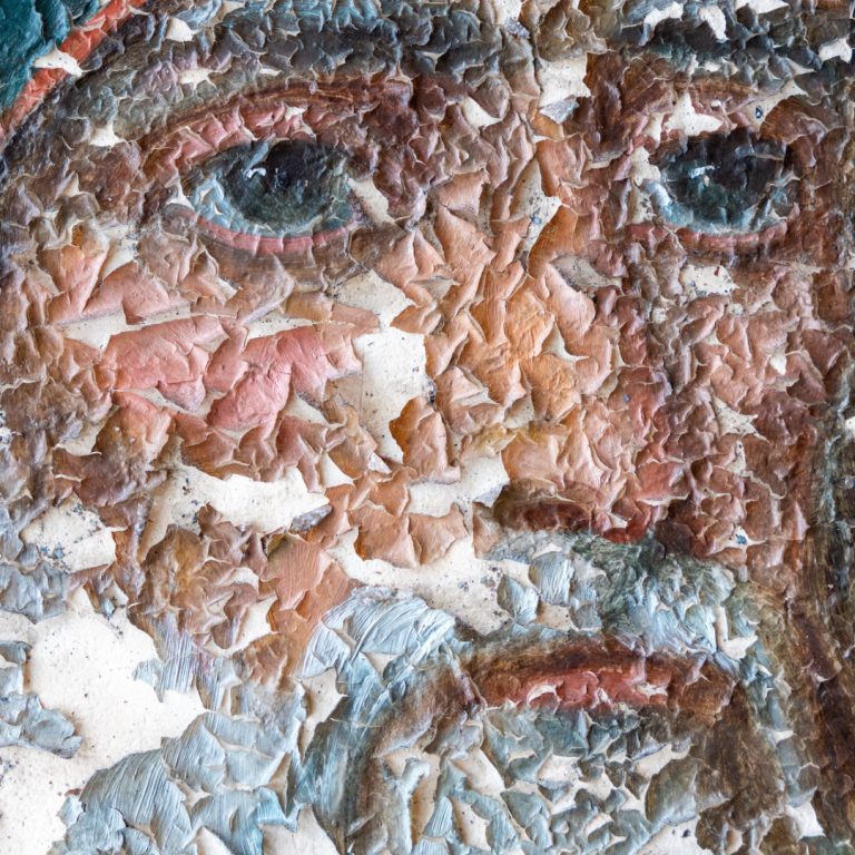 Christ’s Skin for Mine: Autoimmune Disease and the Christian Life